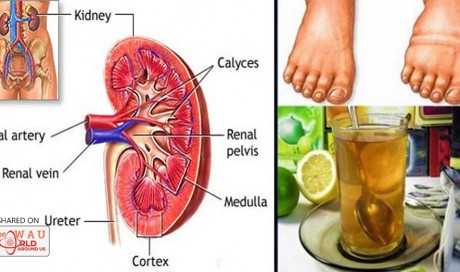  Homemade Remedy That Will Help You Cleanse Your Kidneys and Filter Your Blood Stream!