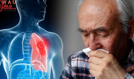 Lung cancer symptoms: If this happens to your fingers you could have the deadly disease