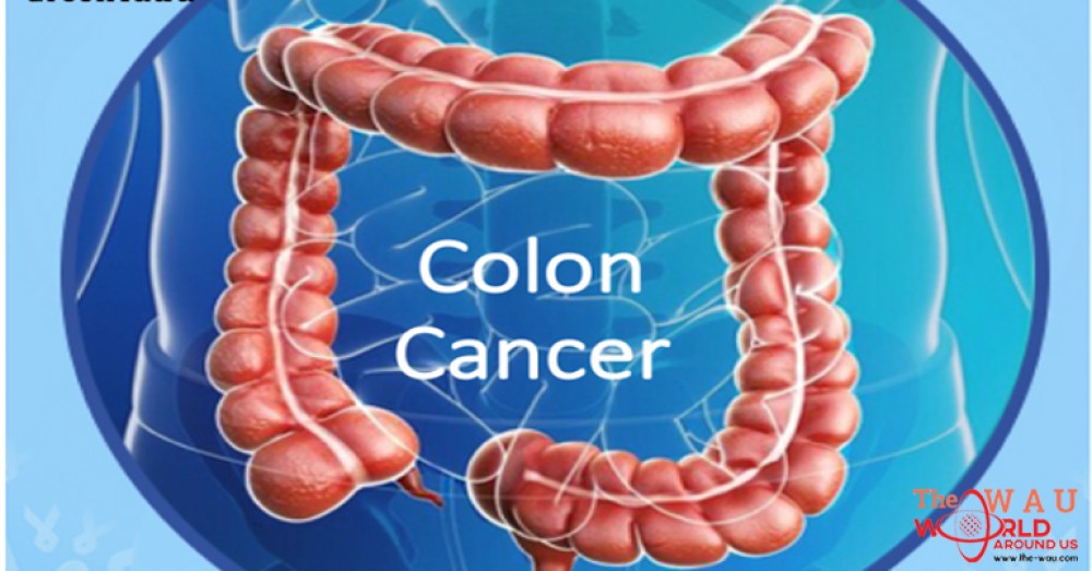 9 Tips for Colon Cancer Survivals!