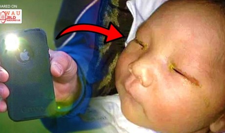Three-Month-Old Baby Goes Blind In One Eye After Someone Took His Picture With Bright Flash. Must Read!