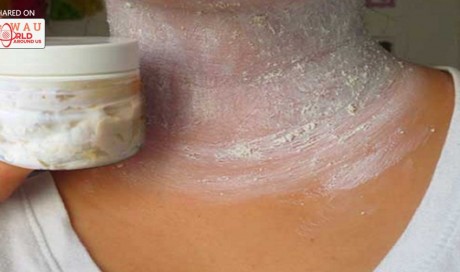 APPLY THIS AND ELIMINATE THOSE ANNOYING DARK SPOTS ON YOUR NECK, ARMPITS AND ELBOWS – IN LESS THAN 15 MINUTES