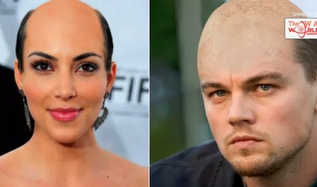 Going Bald: How 20 Stars Would Look Hairless