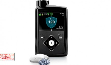 Artificial pancreas approved by FDA  | Science  | WAU |