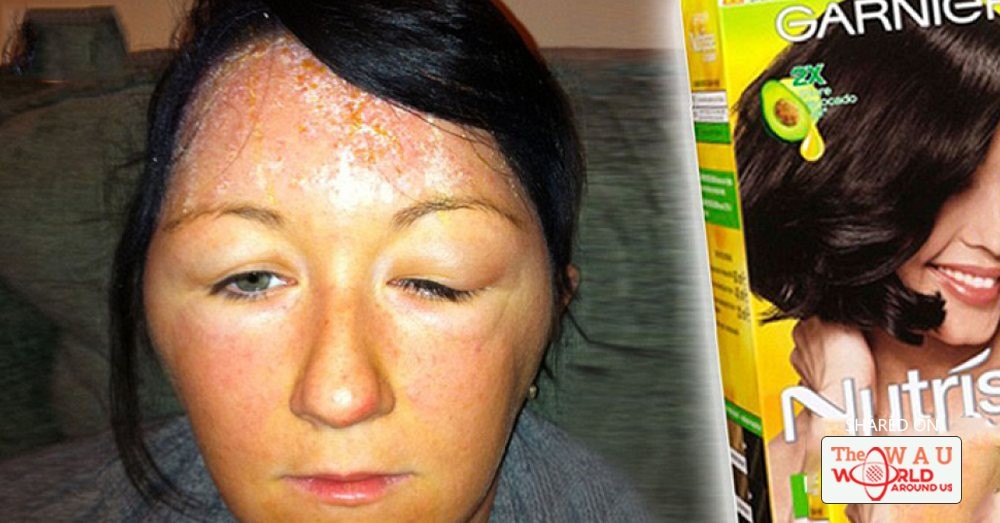 Hair Dyes Are Filled With 5000 Types Of Cancer Causing Chemicals