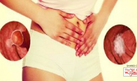 5 Unusual Signs of Colon Cancer People Accidentally Ignore For Years | Blog | Health | WAU