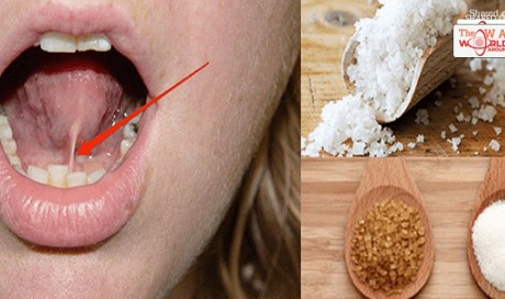 Just Put Salt-Sugar Mixture Under Your Tongue Before You Go To Sleep And What Happens Is Amazing!