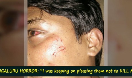 My Story: “Outer Ring Road, Bangalore is never a safer road, Sharing an incident happened to me recently”