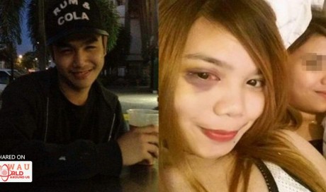 Woman Writes Open Letter Ex Who Physically and Verbally Abused her—the Pictures Say it All!