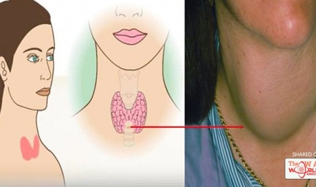 12 Million Women Around Suffer From Thyroid Gland Disorder Because They Ignore These Symptoms! The Consequences Are Fatal!