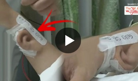 Watch What These Doctors Did To This Man's Arm! The Results Will Amaze You!