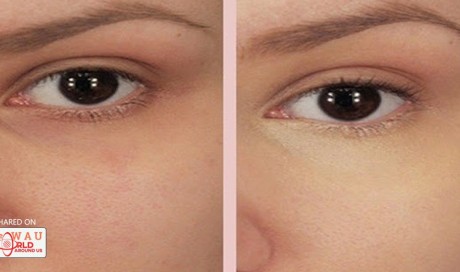 Put Baking Soda Under Your Eyes and the Results Will Be Amazing!