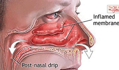 DIY: How To Clear Your Sinuses in Seconds Using Nothing but Your Fingers