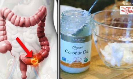 According to New Study, 93% of Colon Cancer is Killed in Only 2 Days After Using Coconut Oil