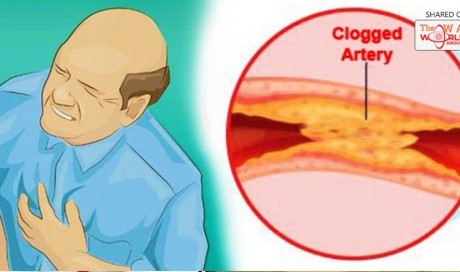 20 Foods That Will Clean Your Arteries Naturally And Protect You From Heart Attacks!