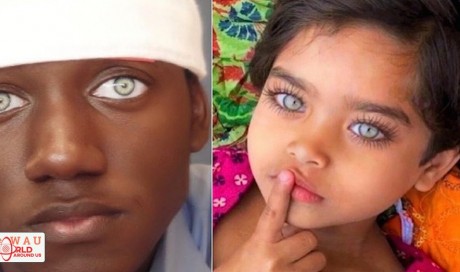 8 Most Beautiful Eyes In The World That Are Sure To Hypnotize You