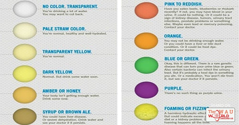 Urine Color Chart And Meaning Colour Chart For Urine