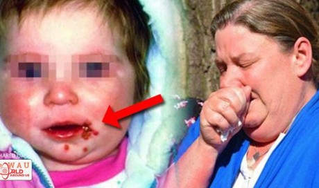 Avoid Kissing Your Children On The Lips To Avoid Tragedy Like This One