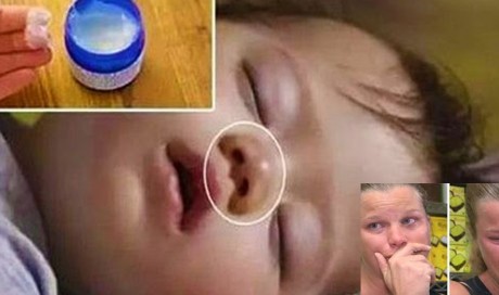 She Applies This Remedy To Her Baby, Shortly After He Dies. Be Careful With This, Moms!