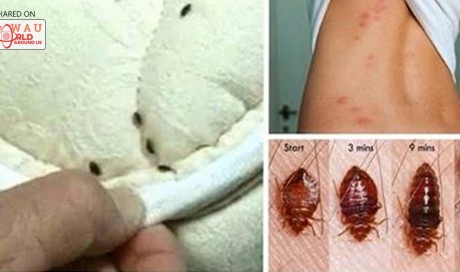 These Bugs reside in your bed and harm your lungs and back while you sleep: learn how to destroy them quickly, easily, and naturally! 