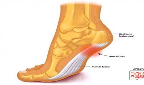 Does Your Heel Hurt in the Morning or Whenever You Stand Up? Here’s What You Need to Know