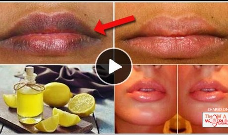 Simple Natural Remedy That Makes Your Lips Soft And Pink In Just 10 Minutes
