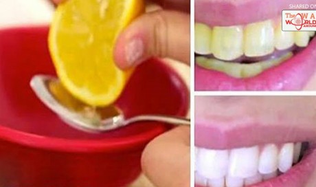 Watch Your Teeth Get White In Just 2 Min With This Home Remedy