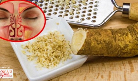 Mix These Two Ingredients And Say Goodbye To Sinusitis, Rhinitis, Influenza, Phlegm And Many More!