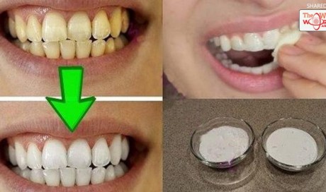 Guaranteed! Whiten Your Yellow Teeth In Less Than 2 Minutes!