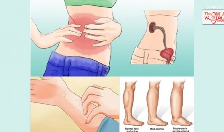 If Your Kidney Is in Danger, The Body Will Give You These 8 Signs!
