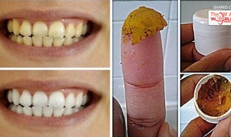 This Homemade Toothpaste Will Definitely Whiten Your Teeth, Heal Your Gums And Get Rid Of Bad Breath