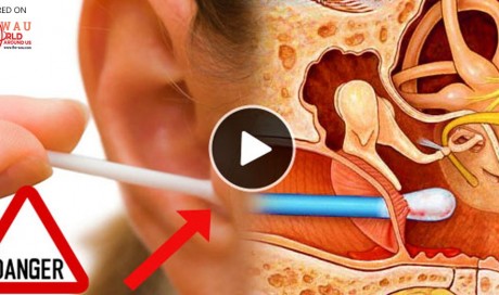  After Watching This, You'll Definitely Stop Using Cotton Buds To Clean Your Ears Again!
