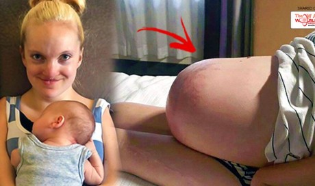 A Mother With No Muscles Miraculously Gives Birth To A Baby!