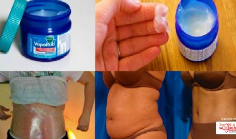 Amazing Uses Of Vicks VapoRub That Provides Relief From A Lot Of Ailments 