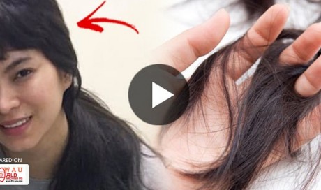 SHOCKING! Angel Locsin Suffered From Hair Loss! FIND OUT THE REASON HERE!