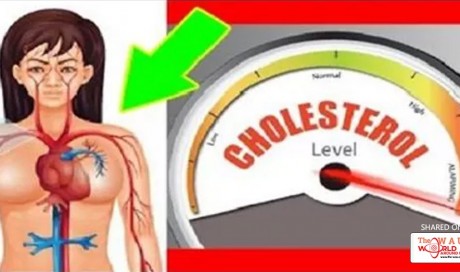 DON’T SPEND ANY MORE MONEY ON MEDICINES FOR HIGH CHOLESTEROL OR HIGH BLOOD PRESSURE – TRY THIS INSTEAD FOR ONLY 7 DAYS!