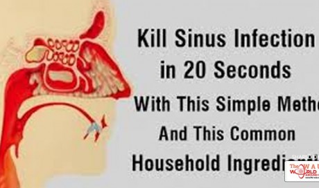 Kill Sinus Infection Within Minutes, With This One of Two Ingredients!
