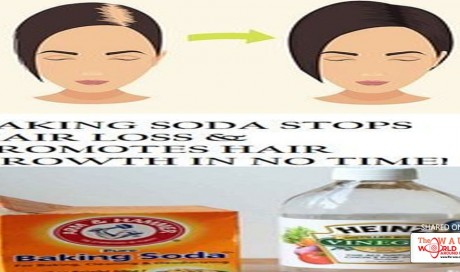 Baking soda stops hair loss & promotes hair growth in no time!