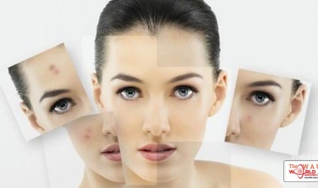 9 Dark Spot Correctors That Erase Acne Scars, Age Spots, and More