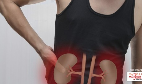 4 Major Functions Of Kidneys And 4 Warning Signs Of Kidney Failure We Often Ignore