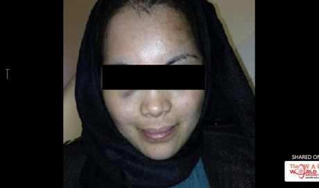 OFW reveals on social media the abuses she suffered from Jordanian husband 