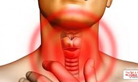Overactive Thyroid (Hyperthyroidism)