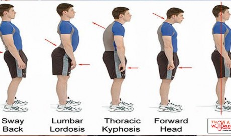 6 Bad Postures That Are Ruining Your Health & How To Correct Them