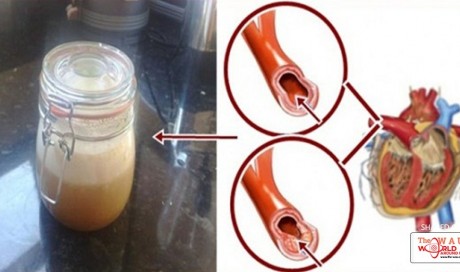SAY GOODBYE TO HIGH BLOOD PRESSURE, CHOLESTEROL, AND TRIGLYCERIDES WITH THIS POWERFUL DRINK!