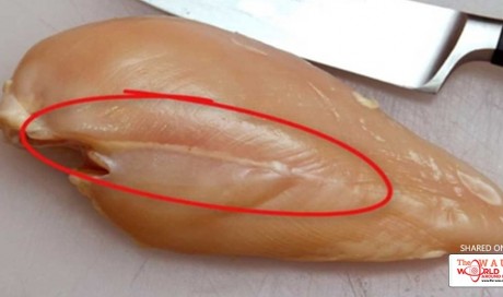 The Price of Progress: if You See These White Lines on Chicken Meat, You Should Think Twice About Eating It
