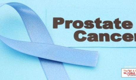 Prostate Cancer Patients May Get Personalised Therapy, Thanks to This Protein