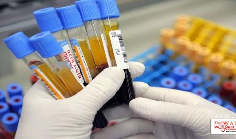 Can A Simple Blood Test Really Spot Cancer Early? Don’t Bet On It Yet, Scientists Say.
