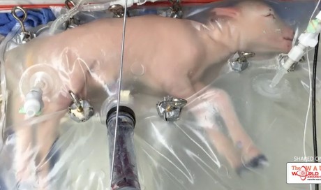 An artificial womb successfully grew baby sheep — and humans could be next