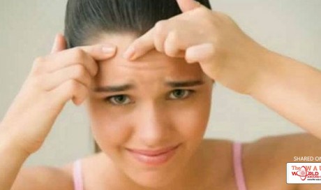 Treat Pimples Overnight With These Simple Beauty Tricks
