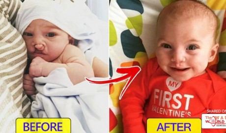 Baby with cleft lip can finally smile, thanks to a stranger who donated and left a kind note to the mom