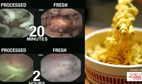 Love Instant Noodles? Watch What Happens To Your Stomach When You Eat Them! This Will Shock You!